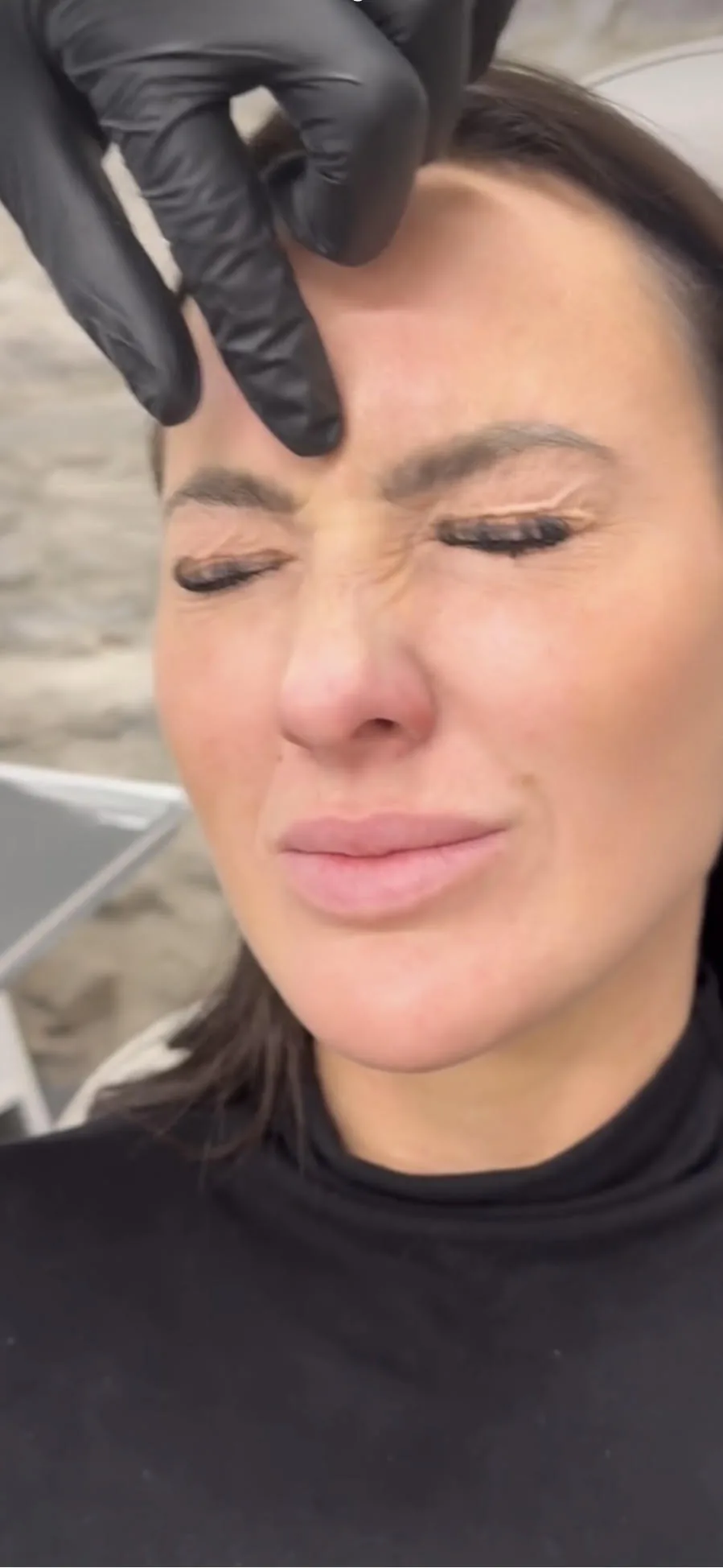 Botox&reg;