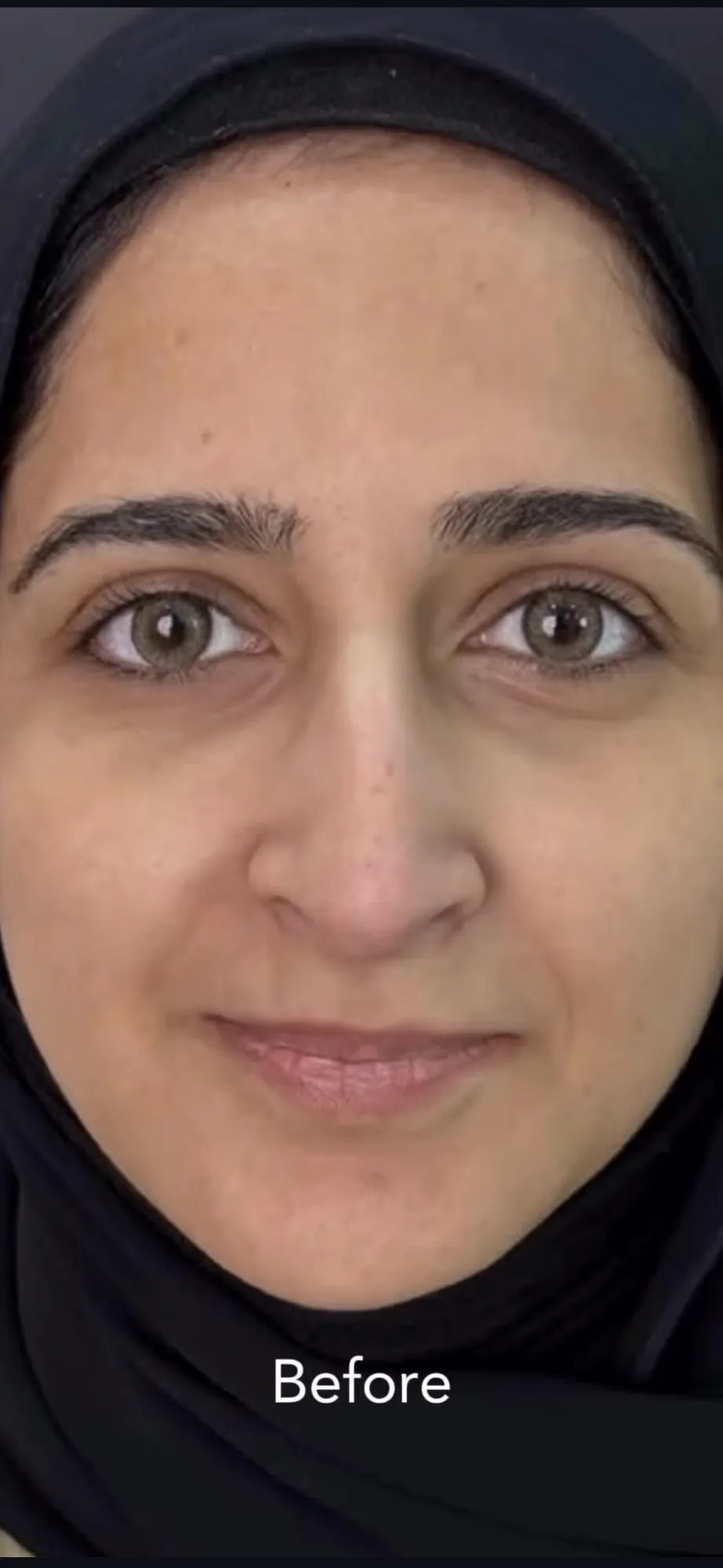 Facial balancing &mdash; before