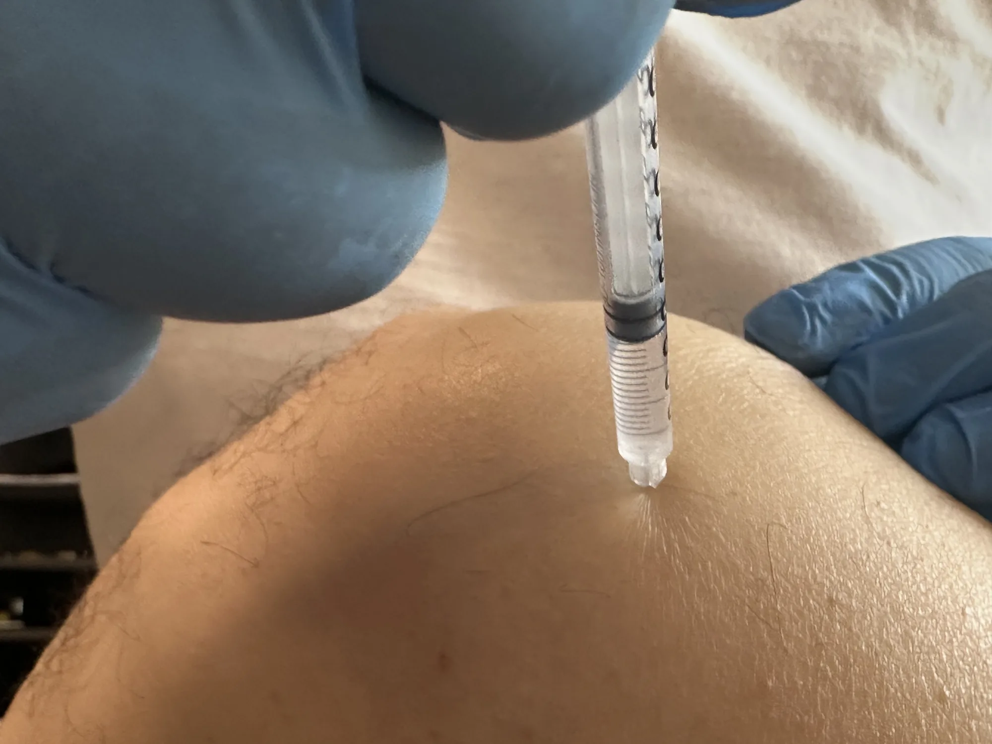 Regenerative & Peptide-Based Hair Treatments