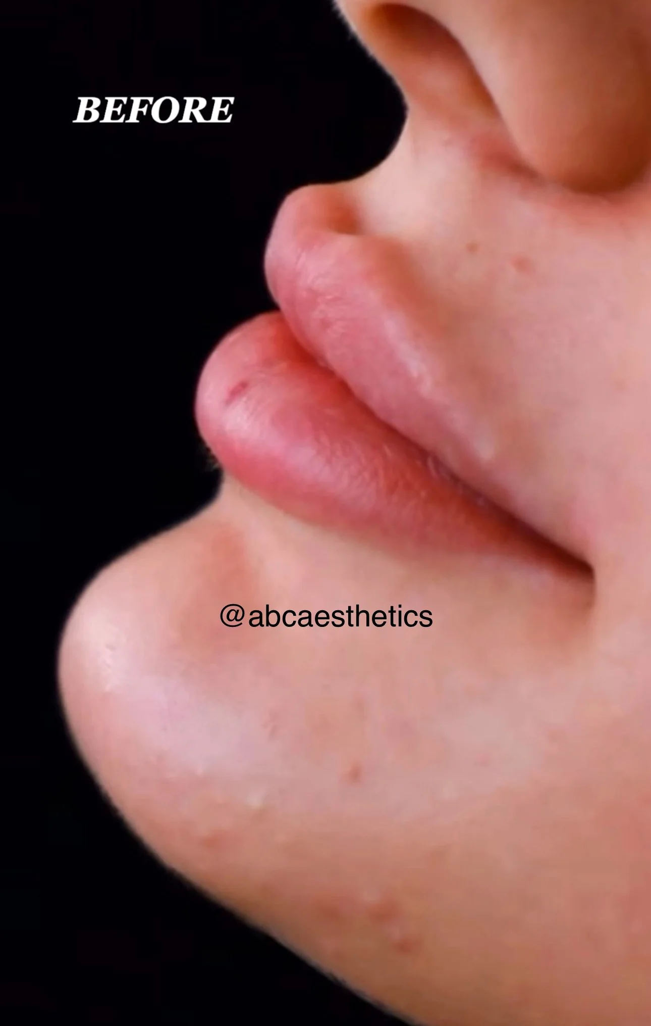 Before treatment