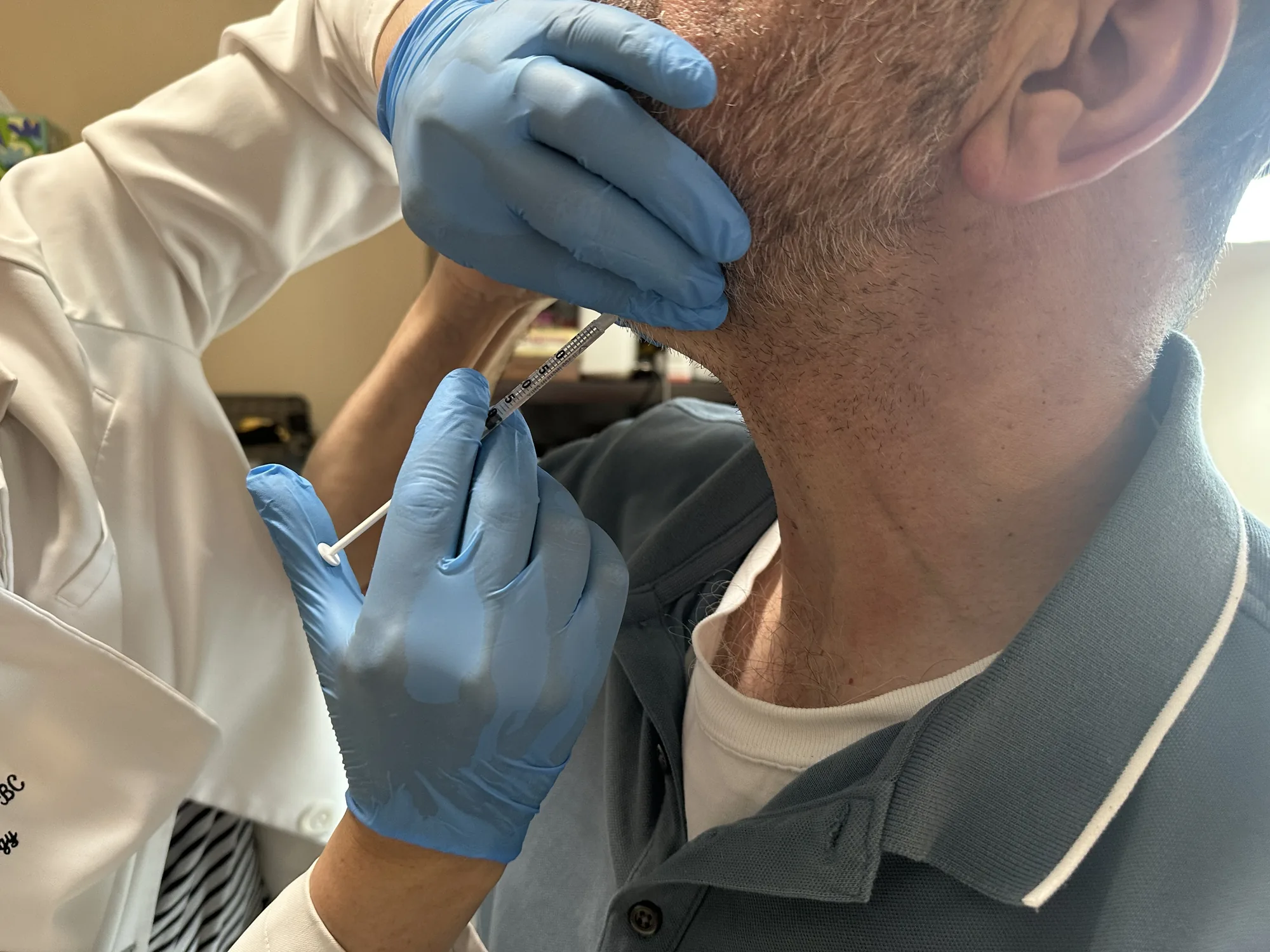 In-office treatment
