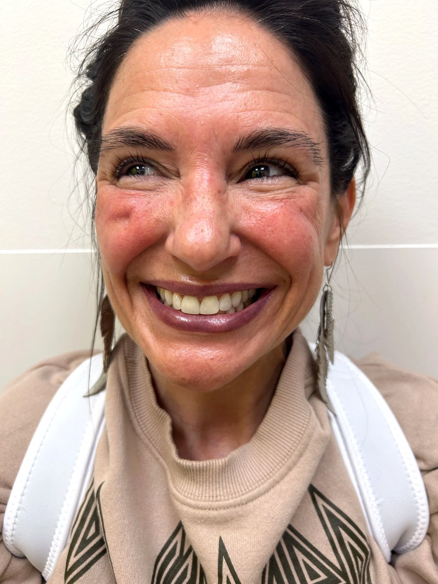 A patient of the practice smiling shortly after an in-clinic facial treatment