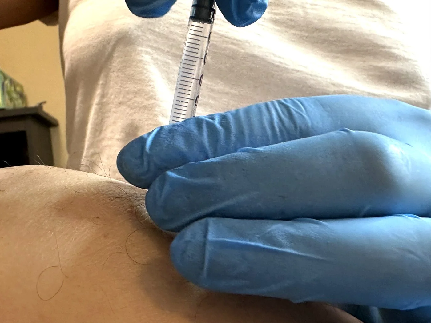 PRP and PRF: regenerative options for skin and hair