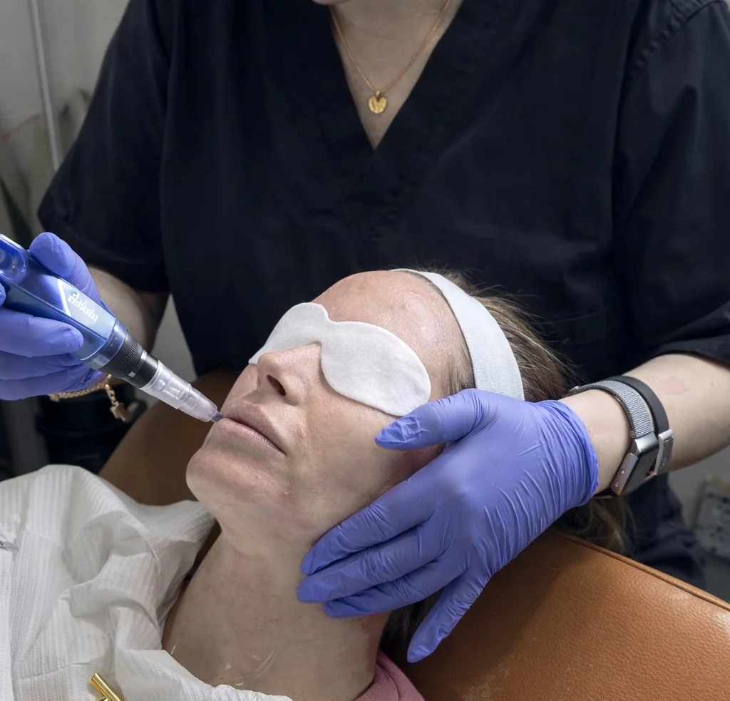 What SkinPen&reg; microneedling is cleared to treat