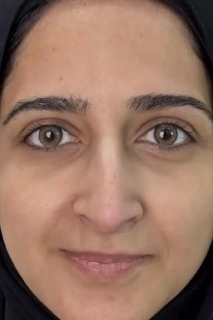 The same patient before treatment